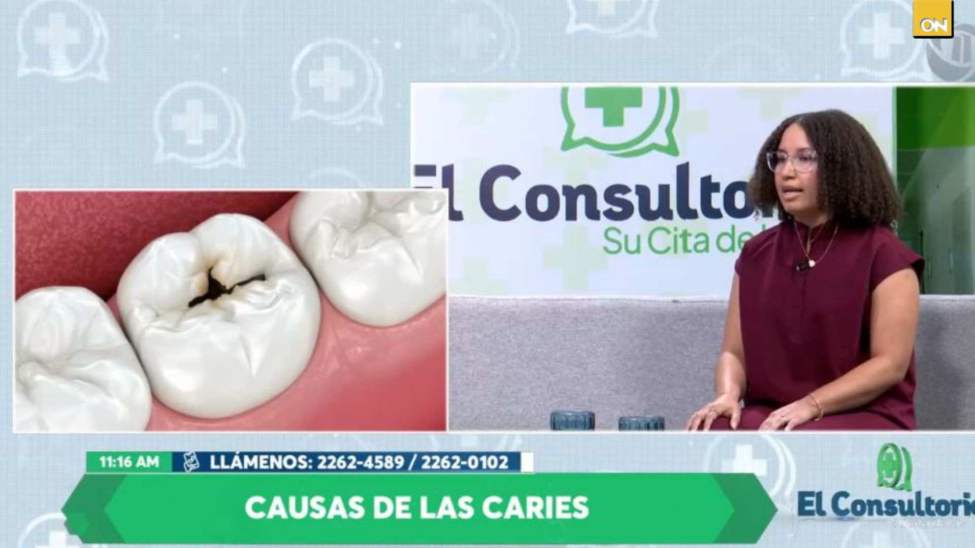 El Consultorio del Once: Experta explica los síntomas y causas de las caries dentales   