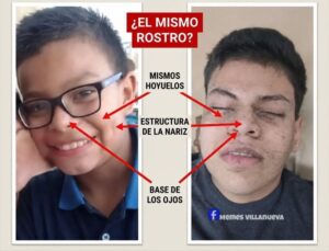 Jove desmayado en Omoa similitudes con Enoc