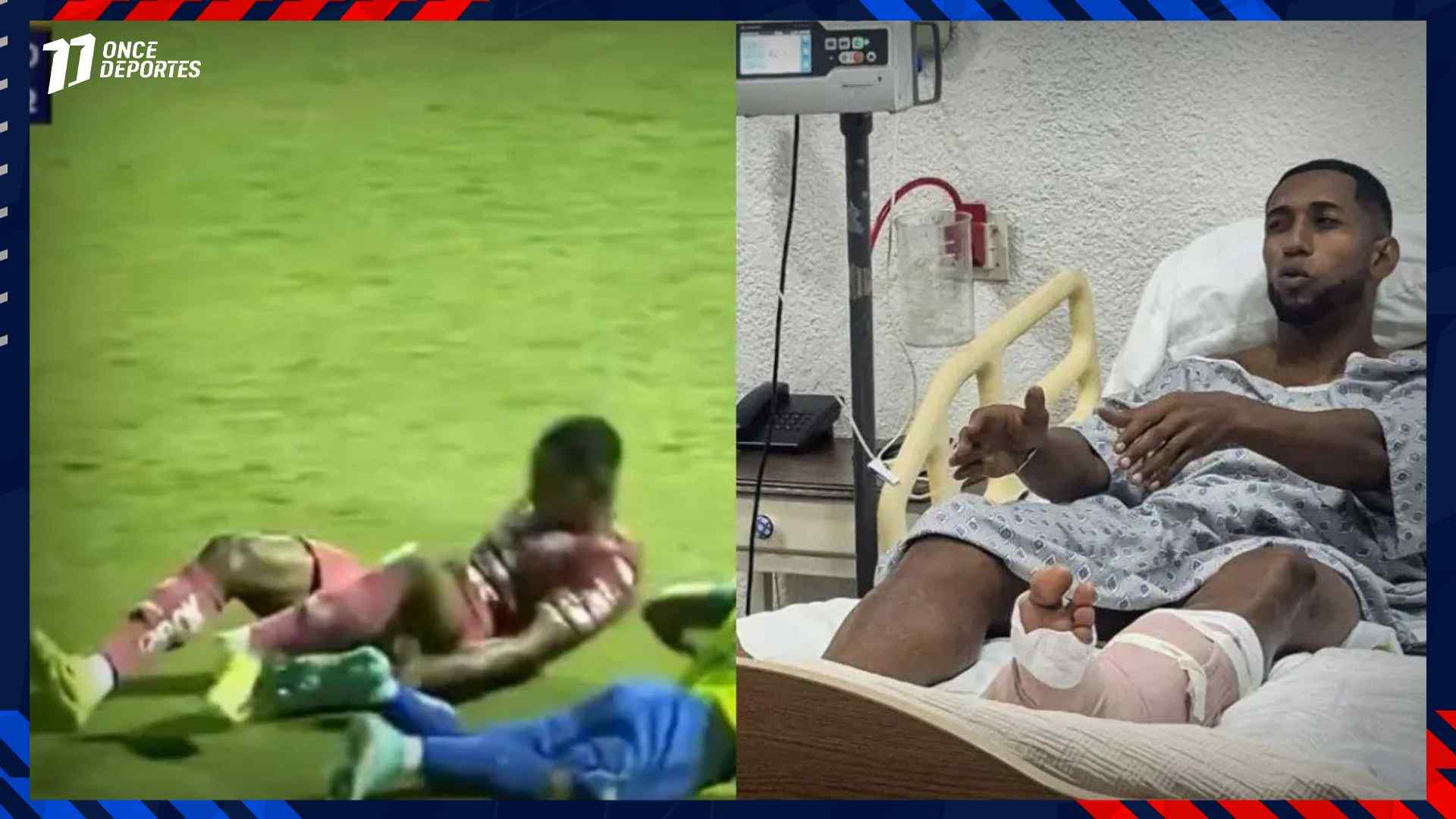 Así quedó el pie de Romario da Silva, jugador del CD Motagua tras grave lesión en el tobillo