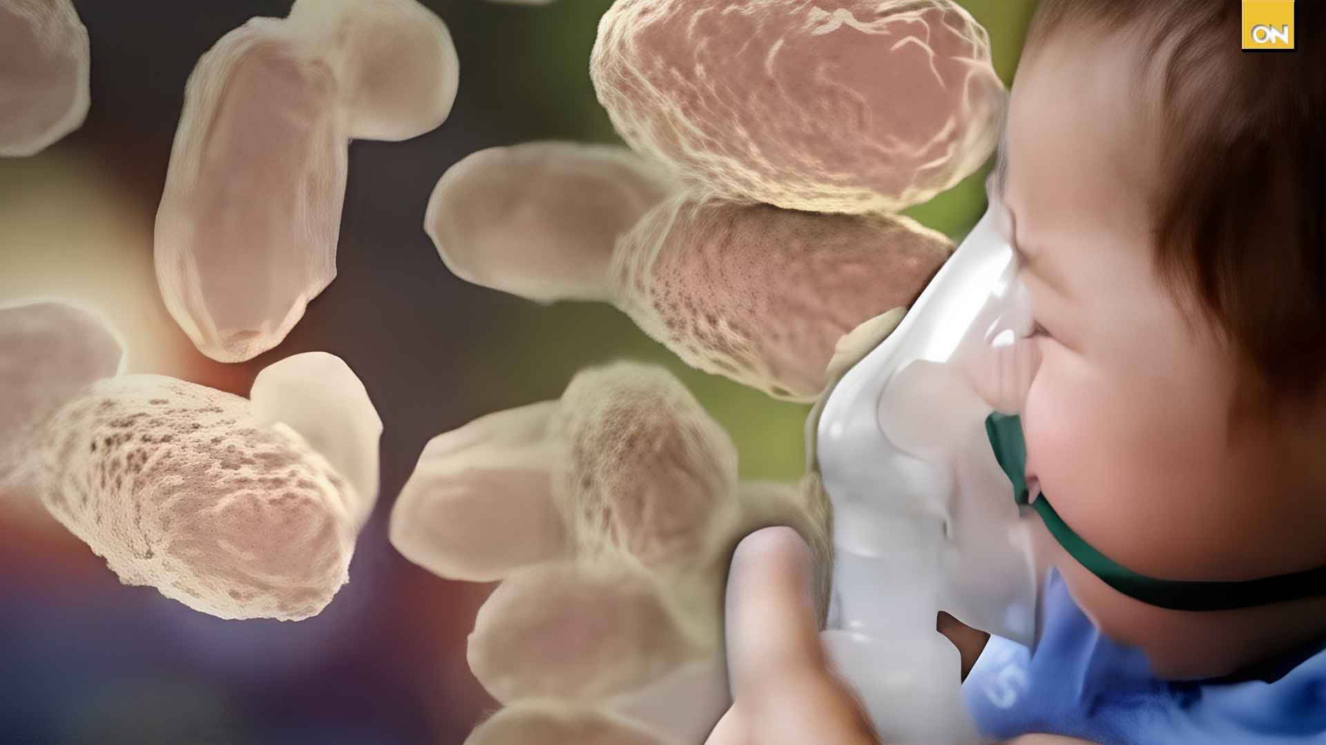 Tosferina en Honduras fallece otro menor y la cifra de decesos sube a 11 en lo que va de 2026