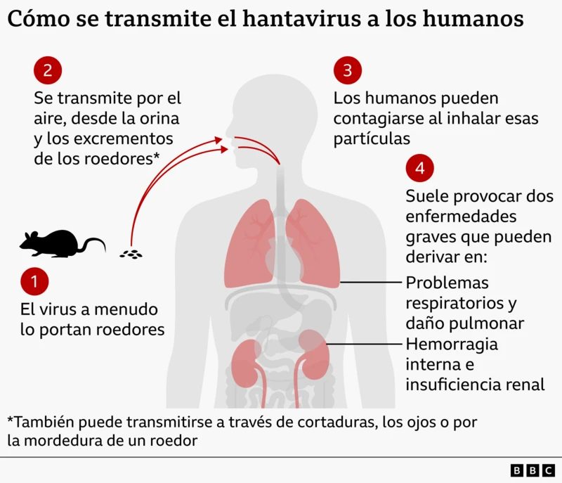 ¿Gripe o hantavirus? síntomas engañosos que comparten estas dos enfermedades 