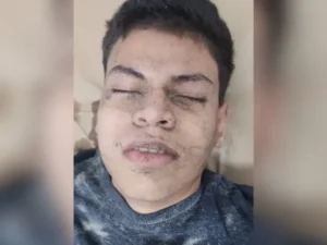 Jove desmayado en Omoa 