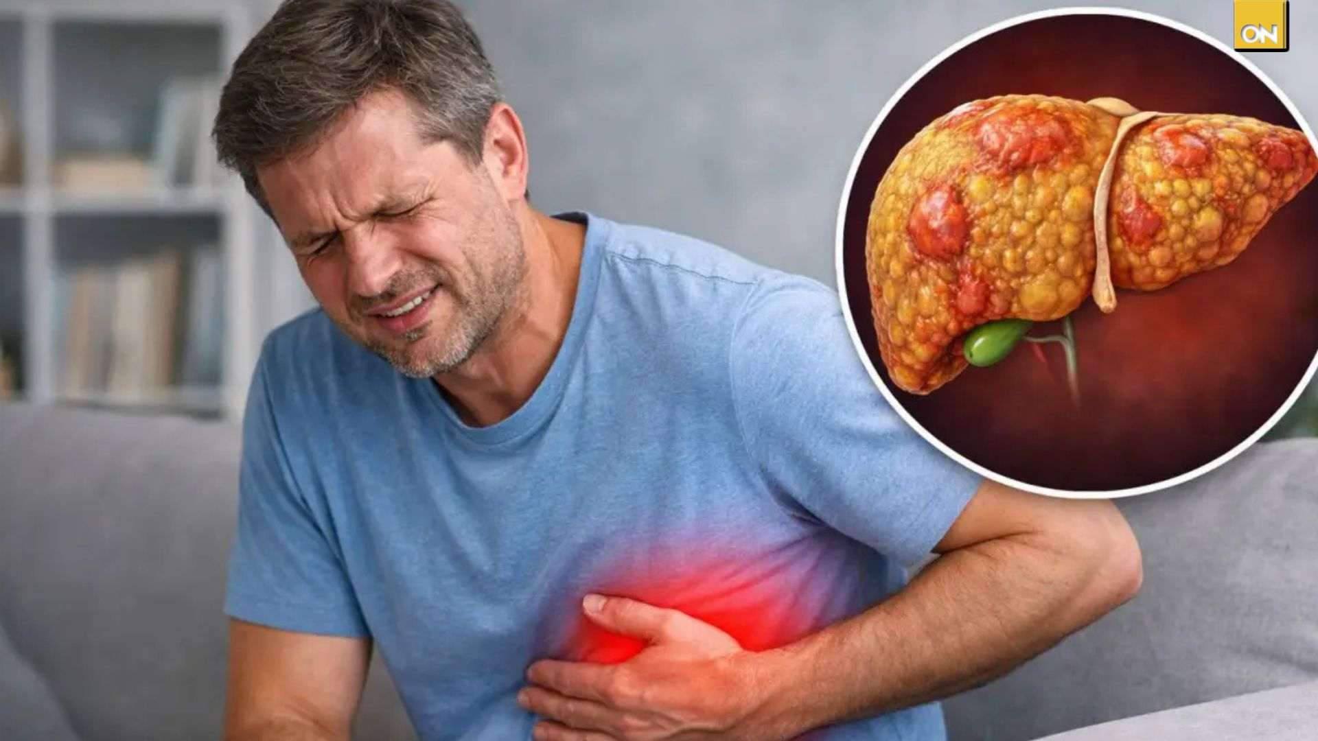  El Consultorio del Once: Dolor en el abdomen y cansancio extremo: ¿Podrán ser síntoma de un hígado graso avanzado?  