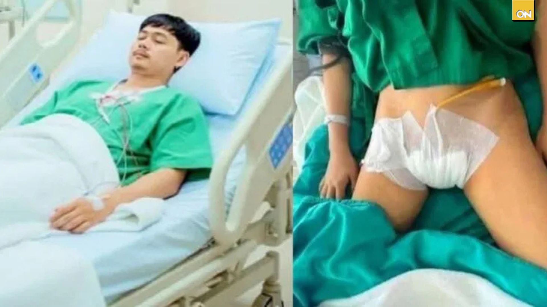 Hombre vendió sus testículos para tunear su auto en tailandia: la historia que desata polémica en redes