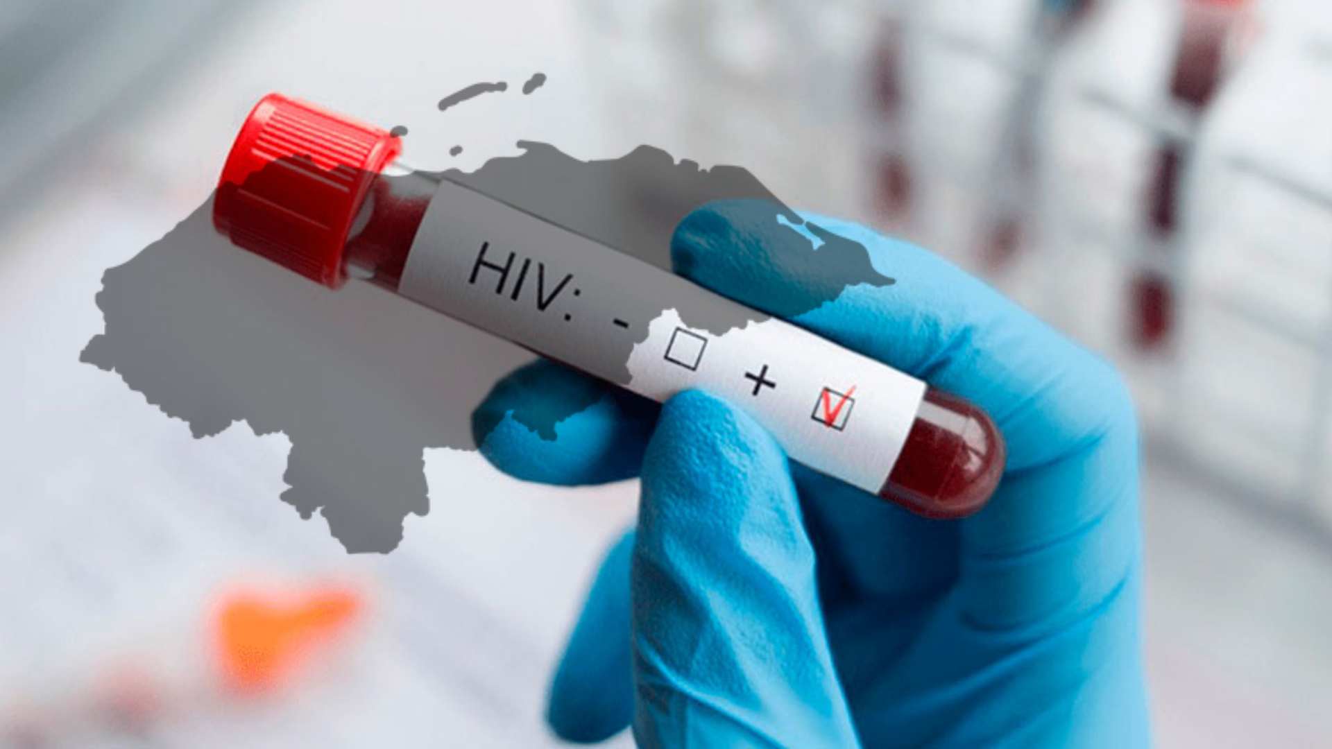Cada 8 horas una persona se infecta de VIH en Honduras