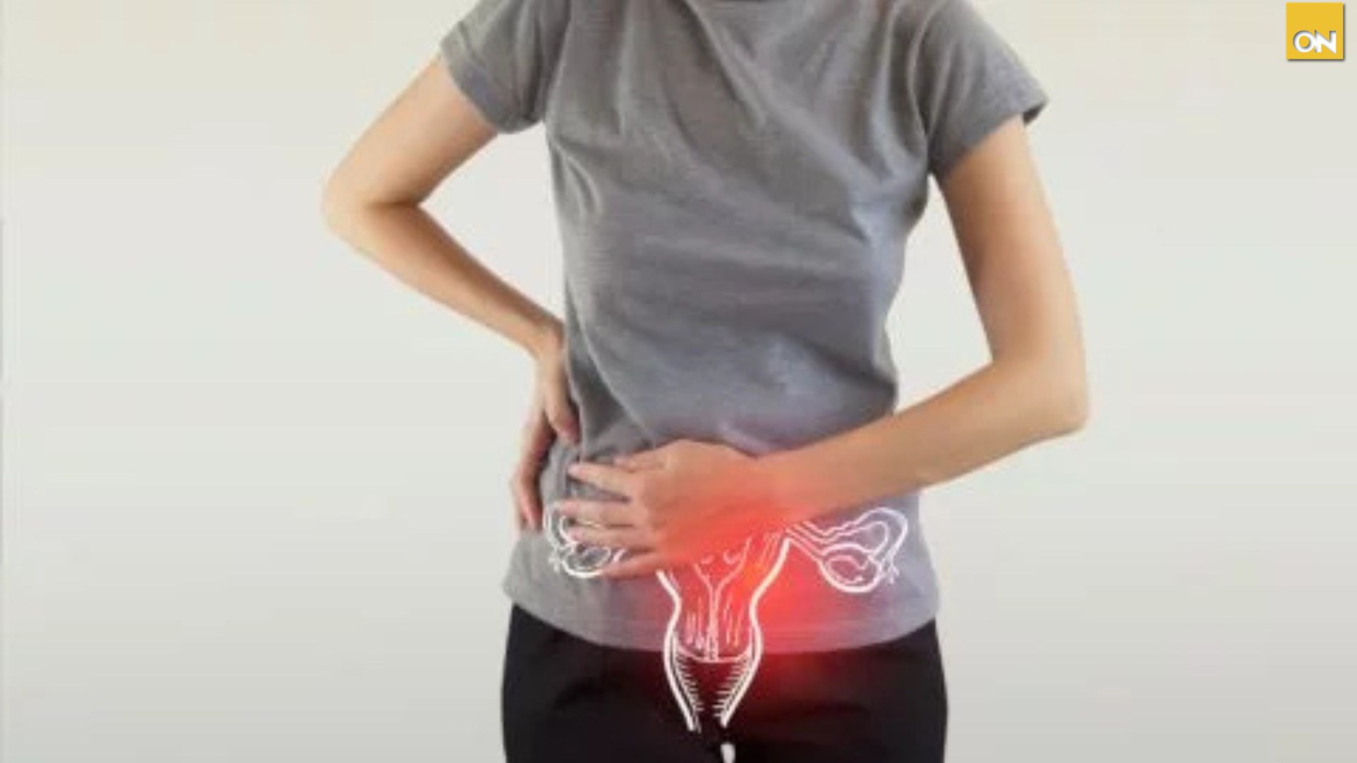 El Consultorio del Once ¿Cómo afectan las infecciones vaginales la salud íntima de las mujeres