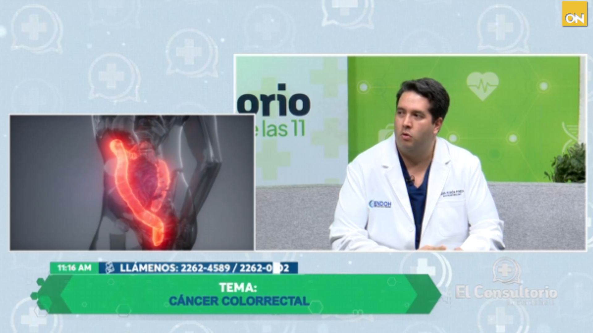 El Consultorio del Once: Cáncer colorrectal, prevención y diagnóstico temprano