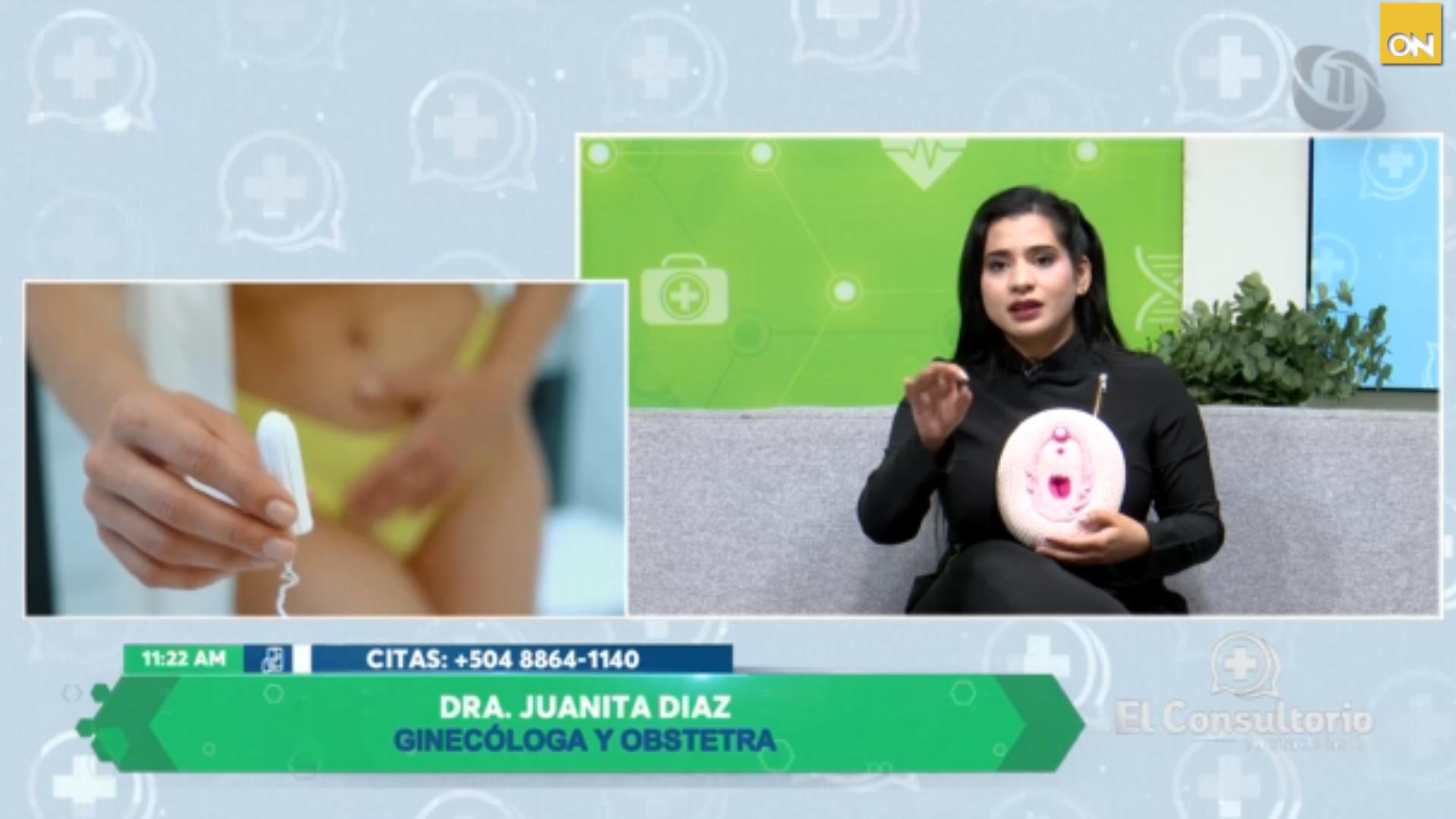 El Consultorio del Once: ¿Cómo reconocer y prevenir las infecciones vaginales?