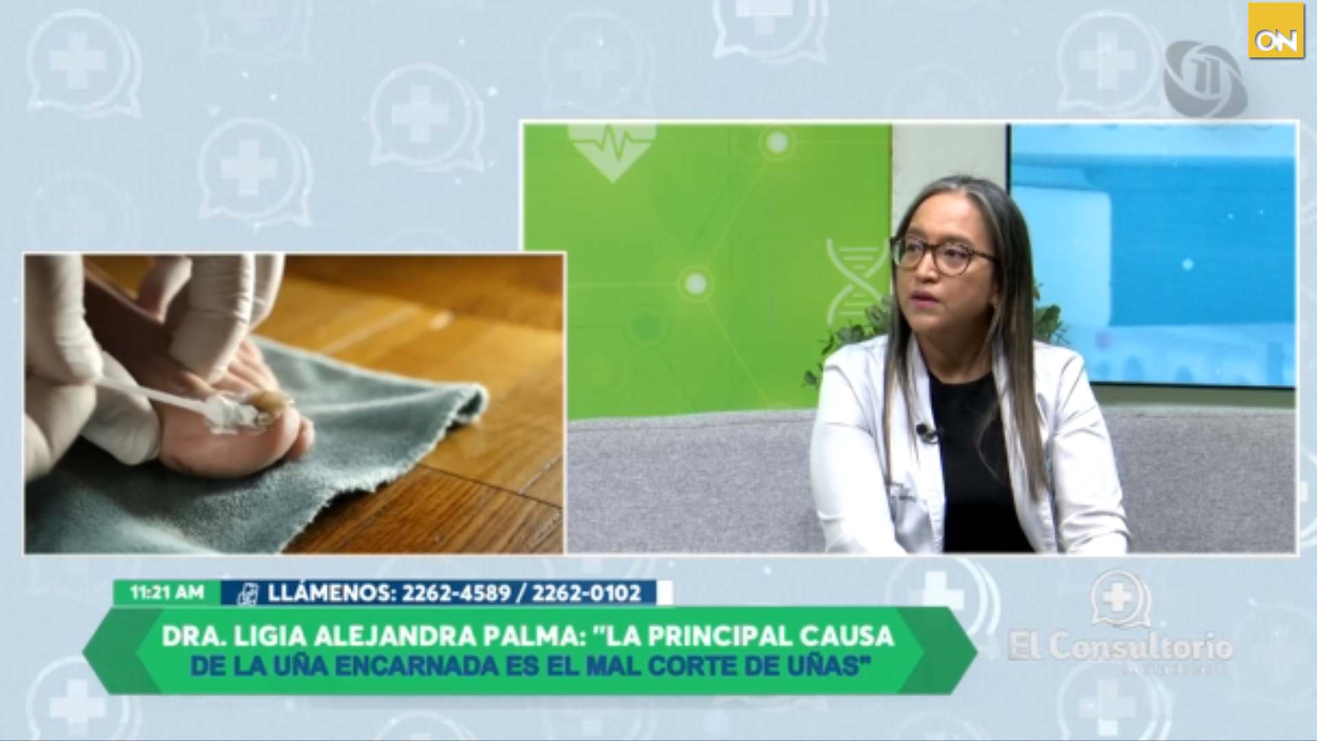 El Consultorio del Once: Uña encarnada, causas y prevención