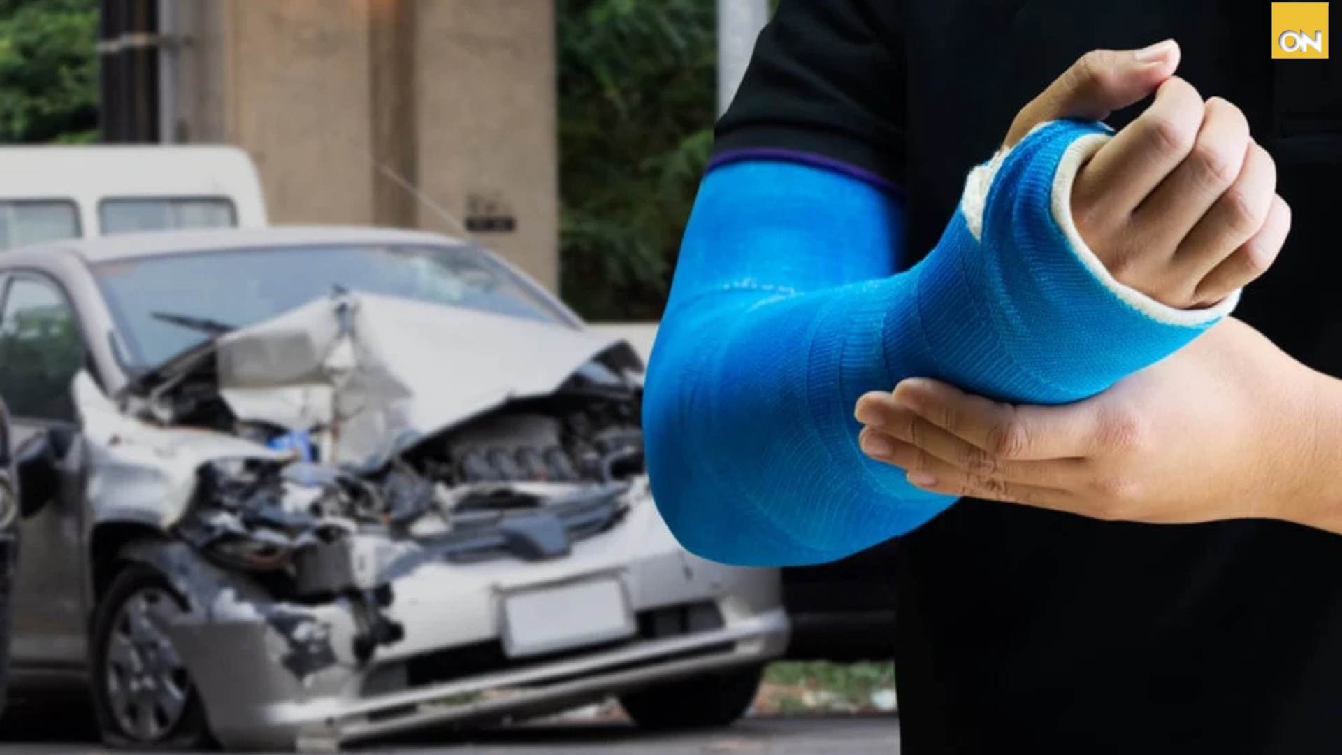 El Consultorio del Once: ¿Cómo afectan las fracturas en accidentes viales la salud de las personas?