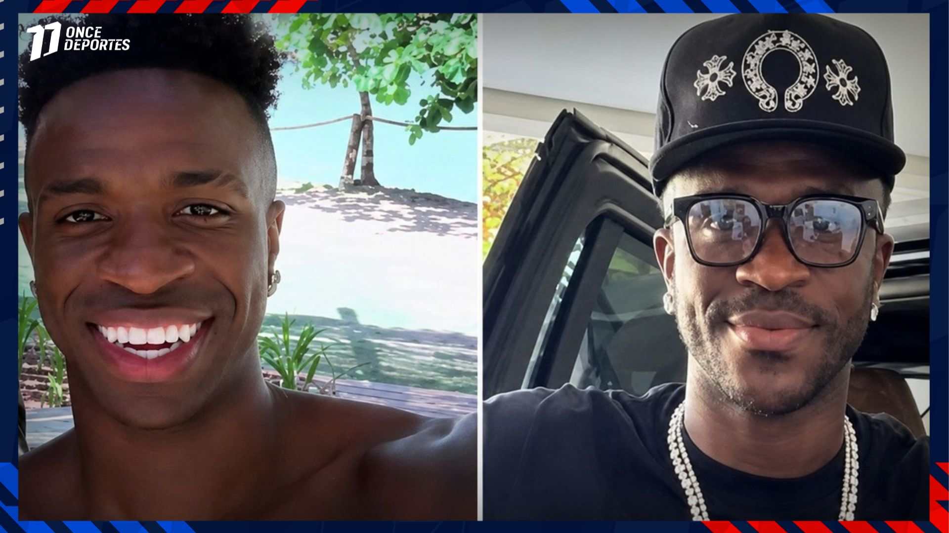 Vinícius Jr cirugía estética