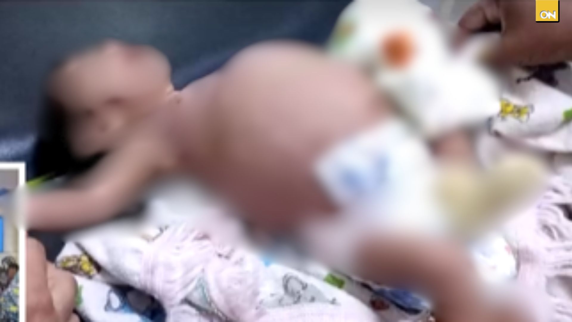 Bebé de 3 meses ingresa grave al HGS, padres se dan a la fuga