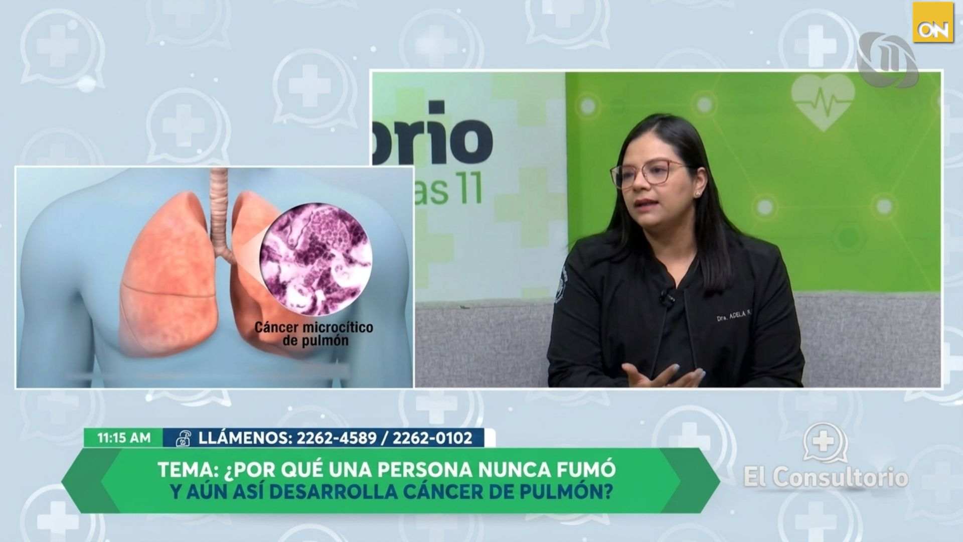 El Consultorio del Once: Cáncer de pulmón en no fumadores