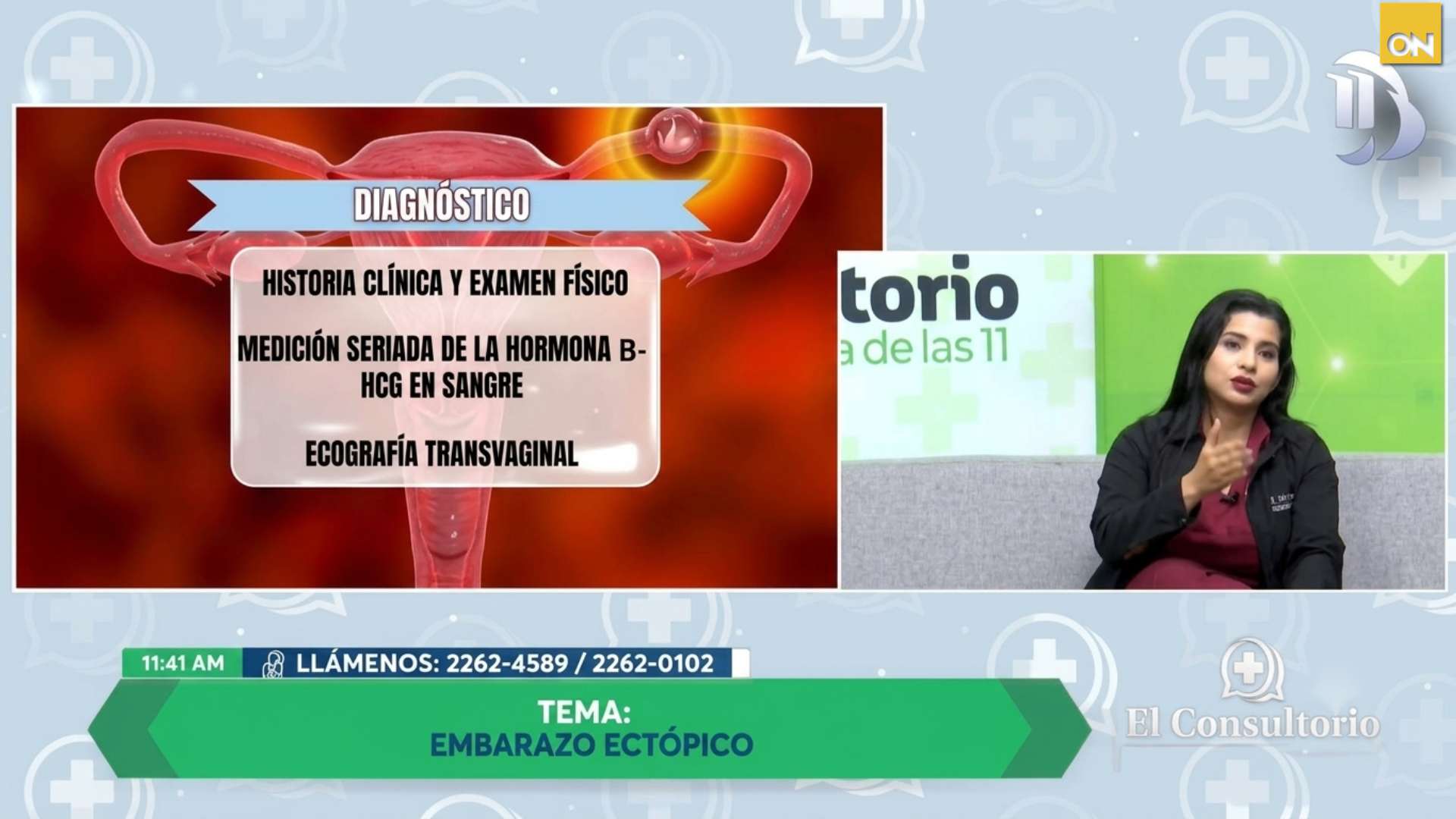 El Consultorio del Once: Embarazo ectópico, ¿qué ocurre cuando la gestación se desarrolla fuera del útero?