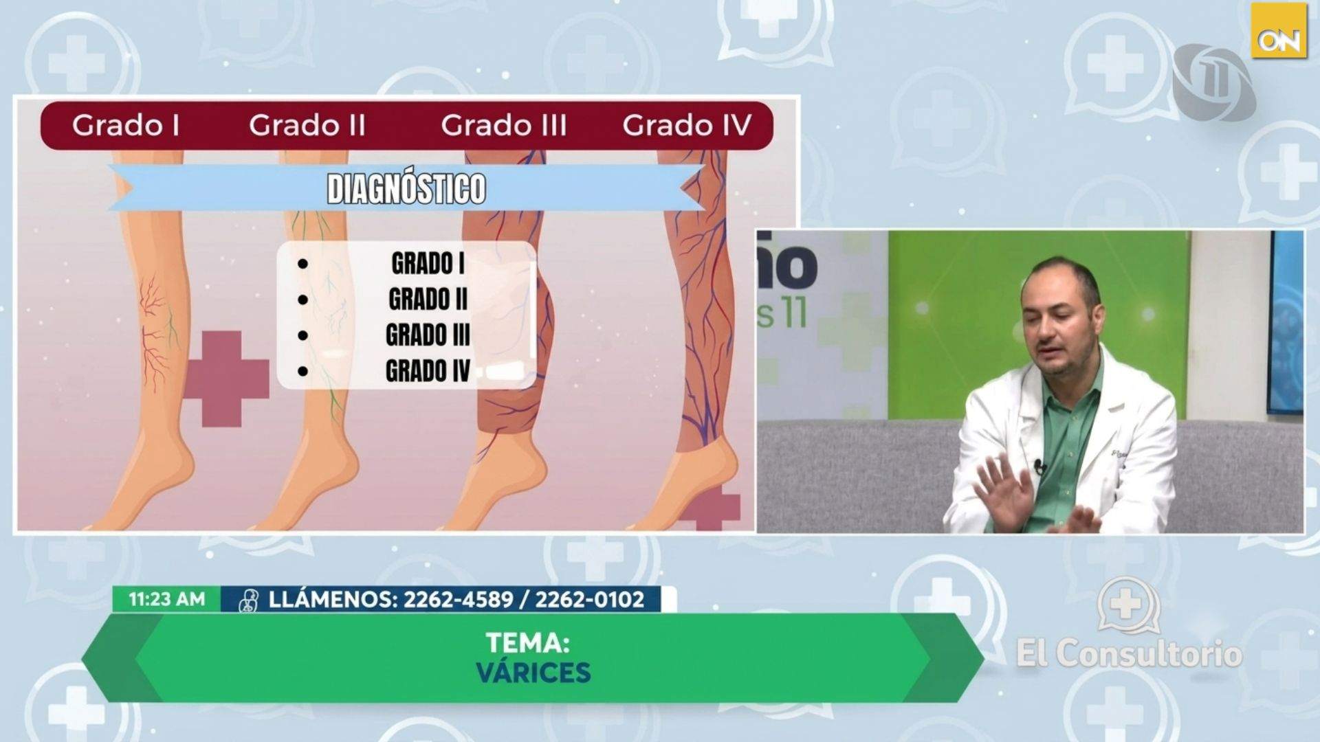 consultorio prevenir várices