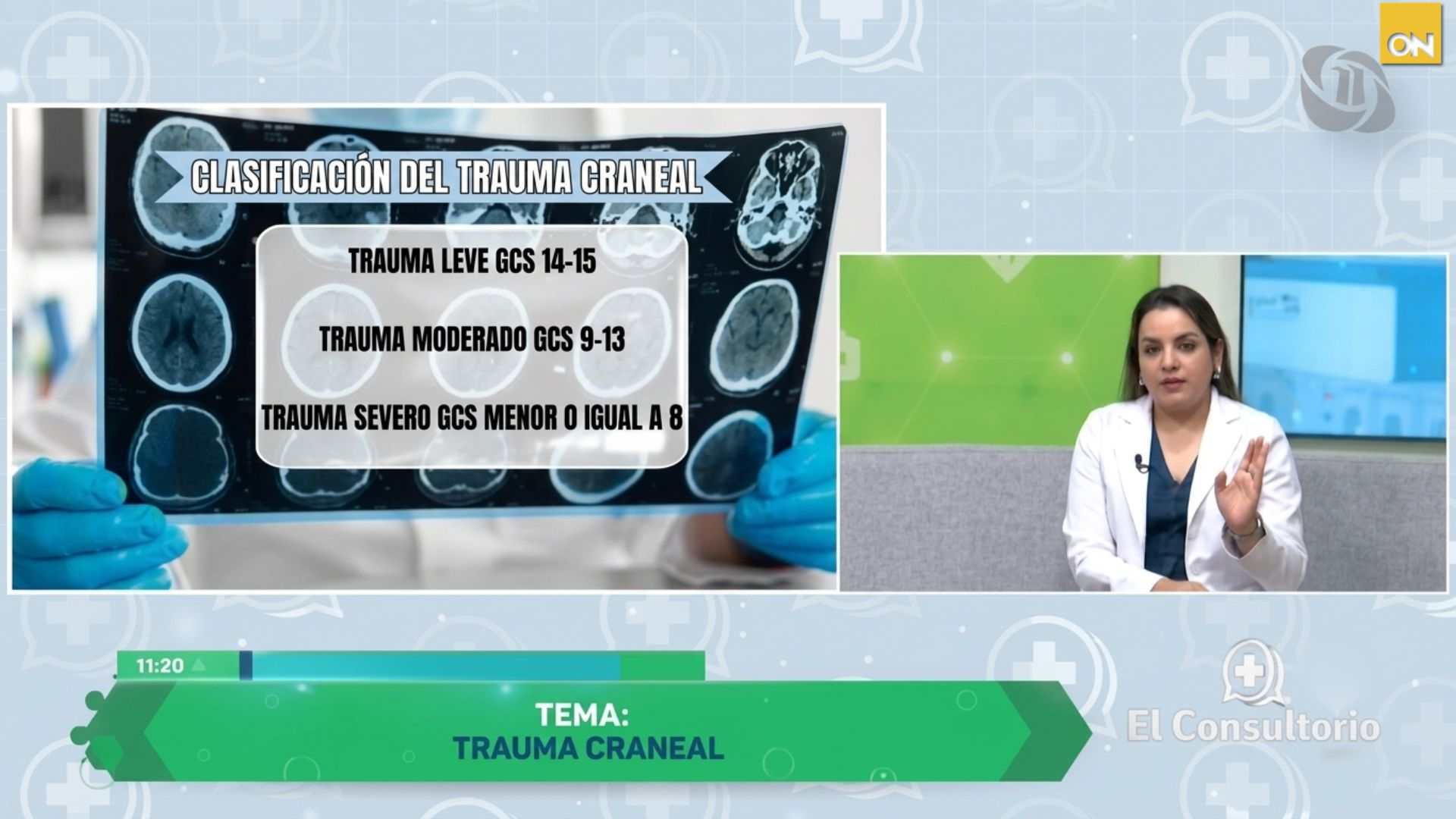 El Consultorio: Trauma craneal, síntomas que no debes ignorar