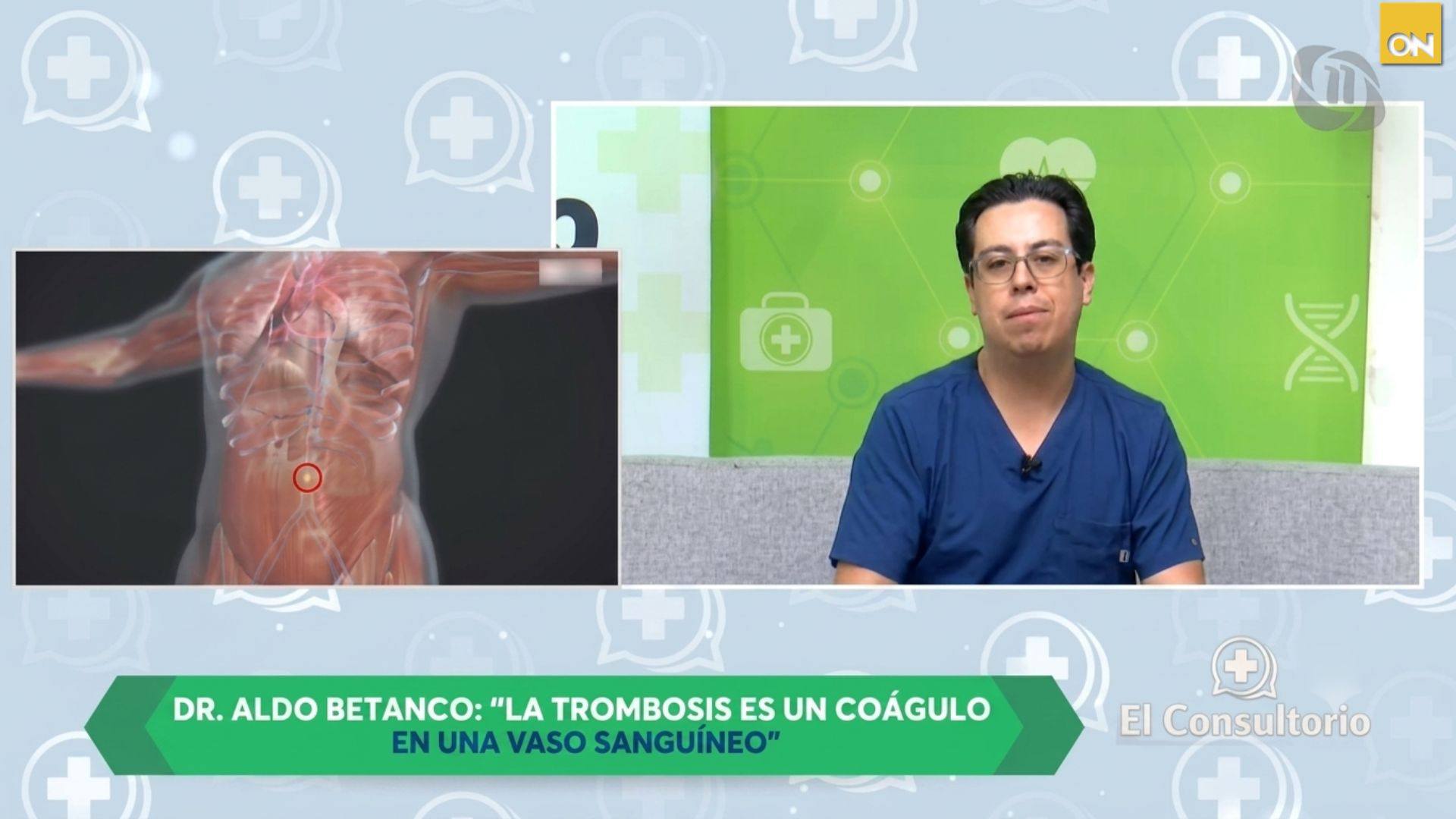 El Consultorio: síntomas de la trombosis