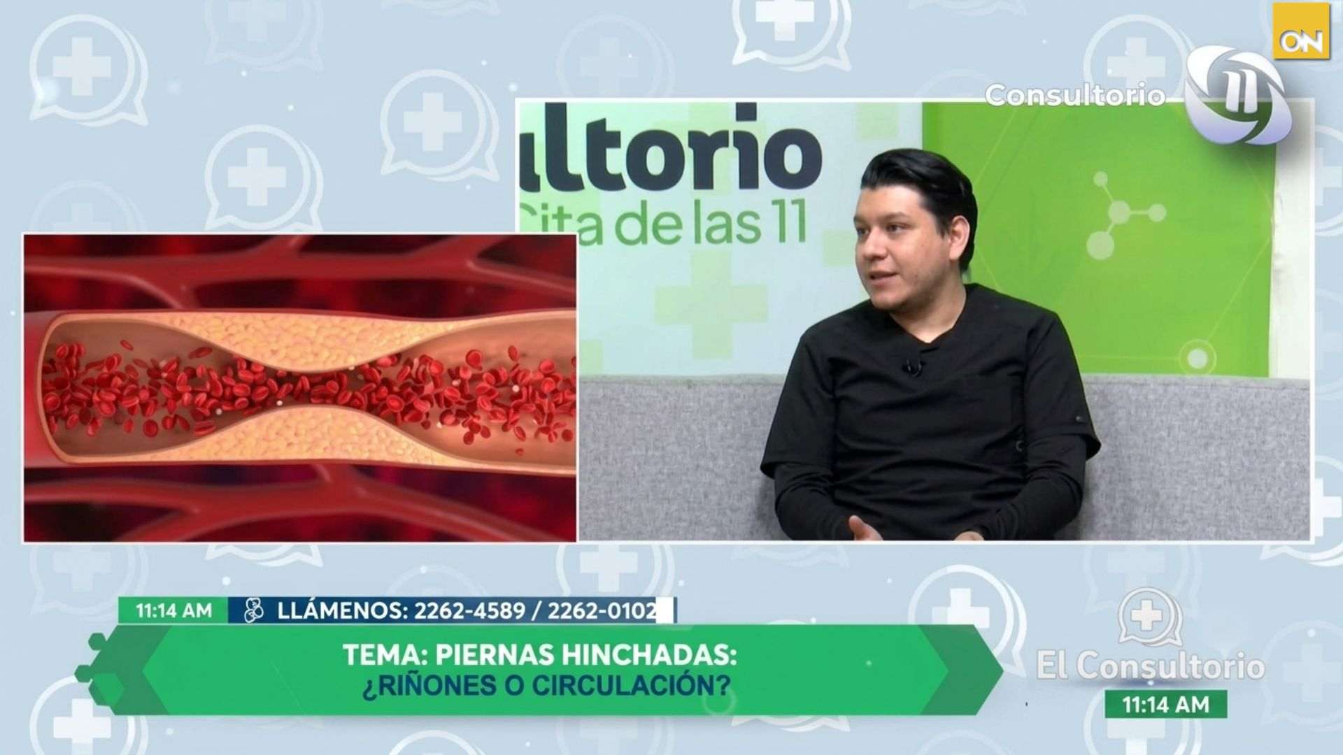 El Consultorio: ¿Piernas hinchadas? Conozca las causas