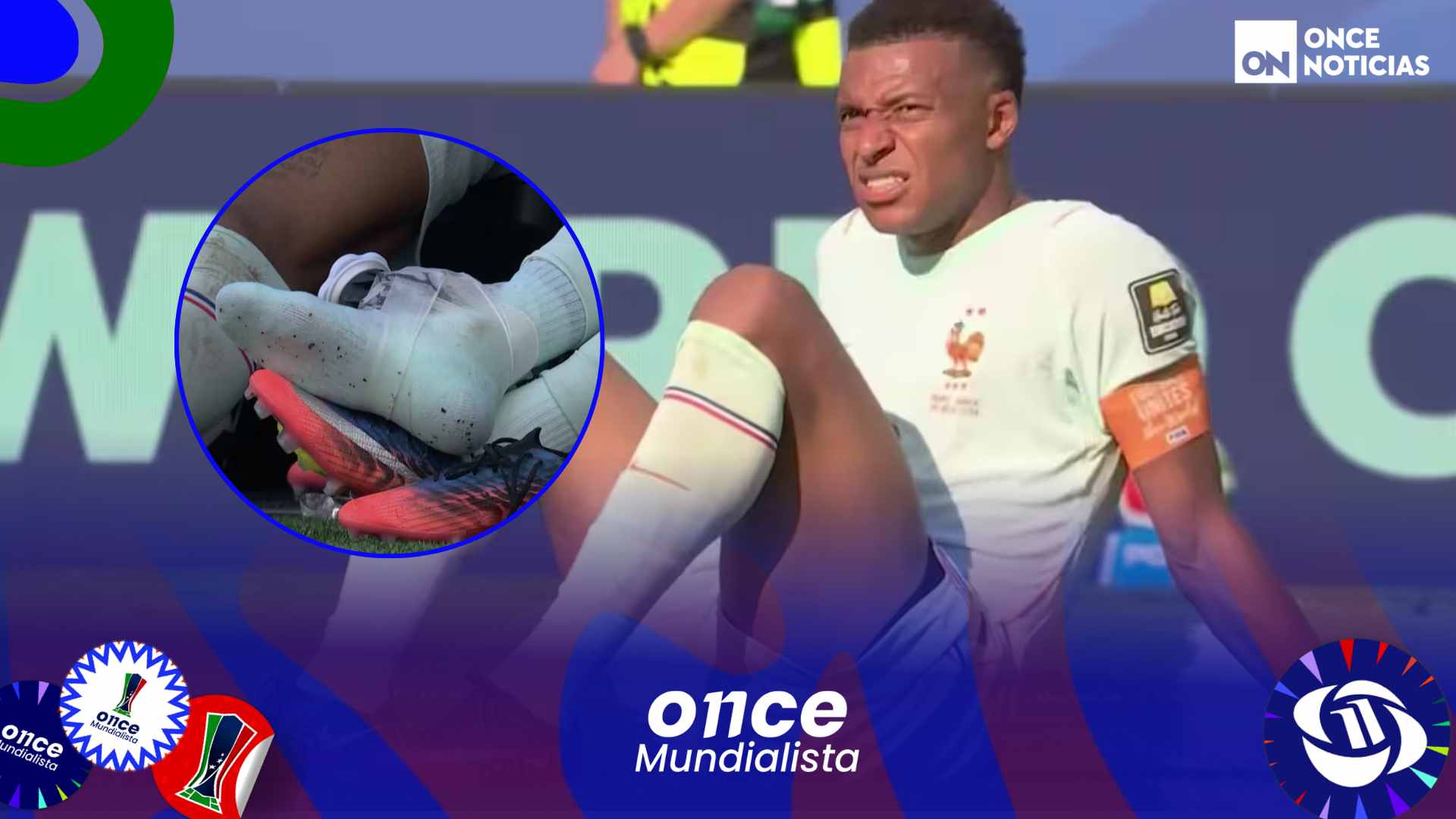 Kylian Mbappé lesión tobillo