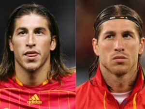 ¿Qué jugadores del Mundial 2026 se han aplicado bótox? ¿CR7 y Neymar entre ellos?